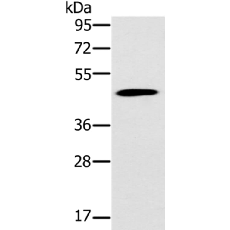KCNJ15 Antibody from Signalway Antibody (37871) - Antibodies.com