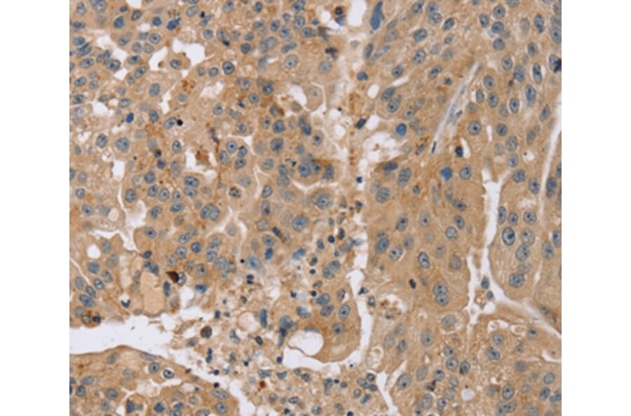 Immunohistochemistry - KCNJ15 Antibody from Signalway Antibody (37871) - Antibodies.com