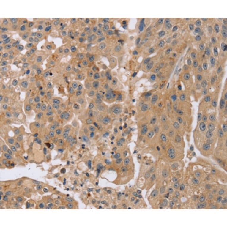 Immunohistochemistry - KCNJ15 Antibody from Signalway Antibody (37871) - Antibodies.com