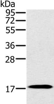 Gel: 10% SDS-PAGE Lysates (from left to right): Mouse heart tissue Amount of lysate: 40ug per lane Primary antibody: 1/300 dilution Secondary antibody dilution: 1/8000 Exposure time: 1 minute