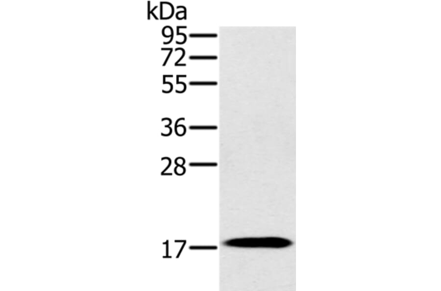 RNF122 Antibody from Signalway Antibody (37872) - Antibodies.com