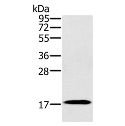 RNF122 Antibody from Signalway Antibody (37872) - Antibodies.com