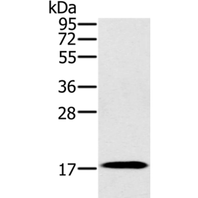RNF122 Antibody from Signalway Antibody (37872) - Antibodies.com