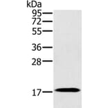 RNF122 Antibody from Signalway Antibody (37872) - Antibodies.com