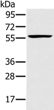 Gel: 8% SDS-PAGE Lysate: 40ug Jurkat cell Primary antibody: 1/250 dilution Secondary antibody dilution: 1/8000 Exposure time: 40 seconds