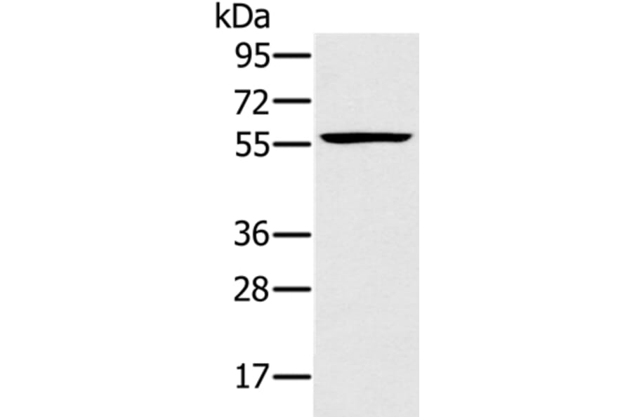 TRIM34 Antibody from Signalway Antibody (37875) - Antibodies.com