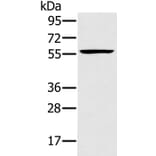 TRIM34 Antibody from Signalway Antibody (37875) - Antibodies.com