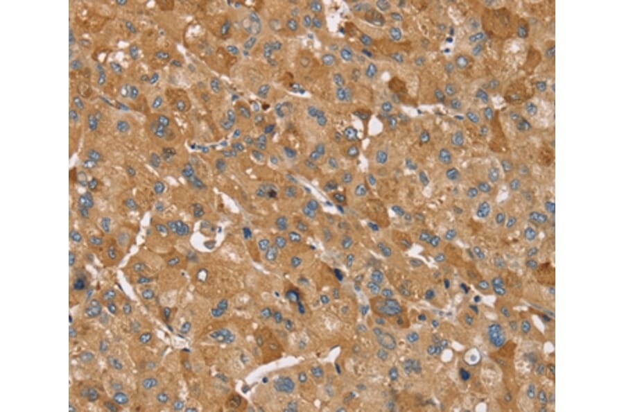 Immunohistochemistry - TRIM34 Antibody from Signalway Antibody (37875) - Antibodies.com