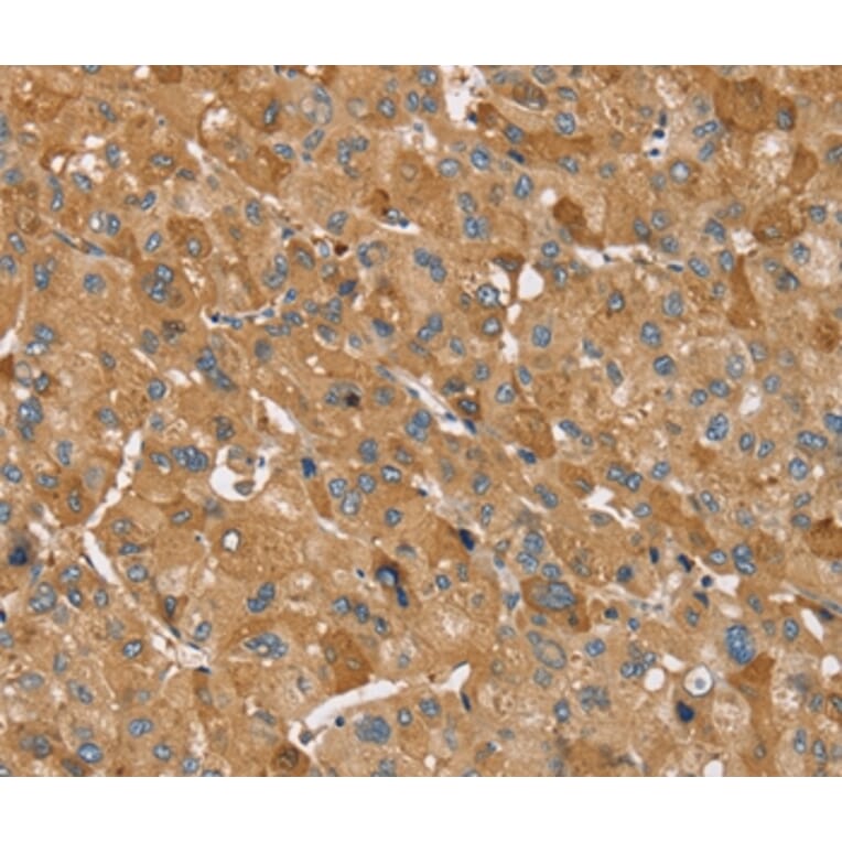 Immunohistochemistry - TRIM34 Antibody from Signalway Antibody (37875) - Antibodies.com