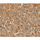 Immunohistochemistry - TRIM34 Antibody from Signalway Antibody (37875) - Antibodies.com