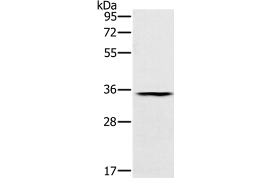 TRIM40 Antibody from Signalway Antibody (37877) - Antibodies.com