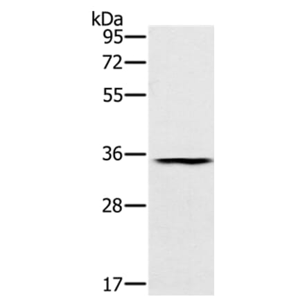 TRIM40 Antibody from Signalway Antibody (37877) - Antibodies.com