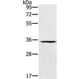 TRIM40 Antibody from Signalway Antibody (37877) - Antibodies.com