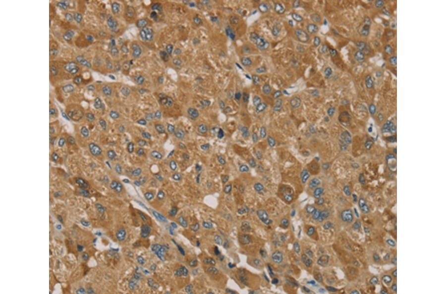 Immunohistochemistry - TRIM40 Antibody from Signalway Antibody (37877) - Antibodies.com