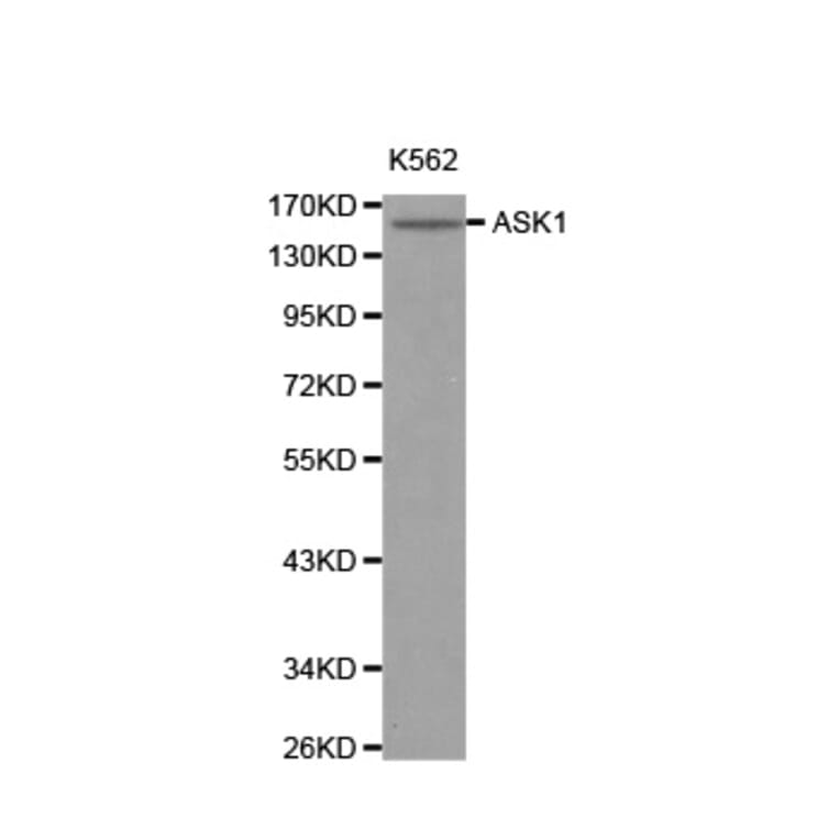 Western blot - MAP3K5 antibody from Signalway Antibody (38125) - Antibodies.com