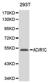 Western blot analysis of 293T cell lysate using ACVR1C antibody.