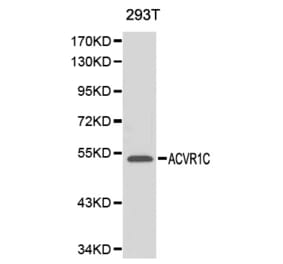 Western blot - ACVR1C antibody from Signalway Antibody (38141) - Antibodies.com