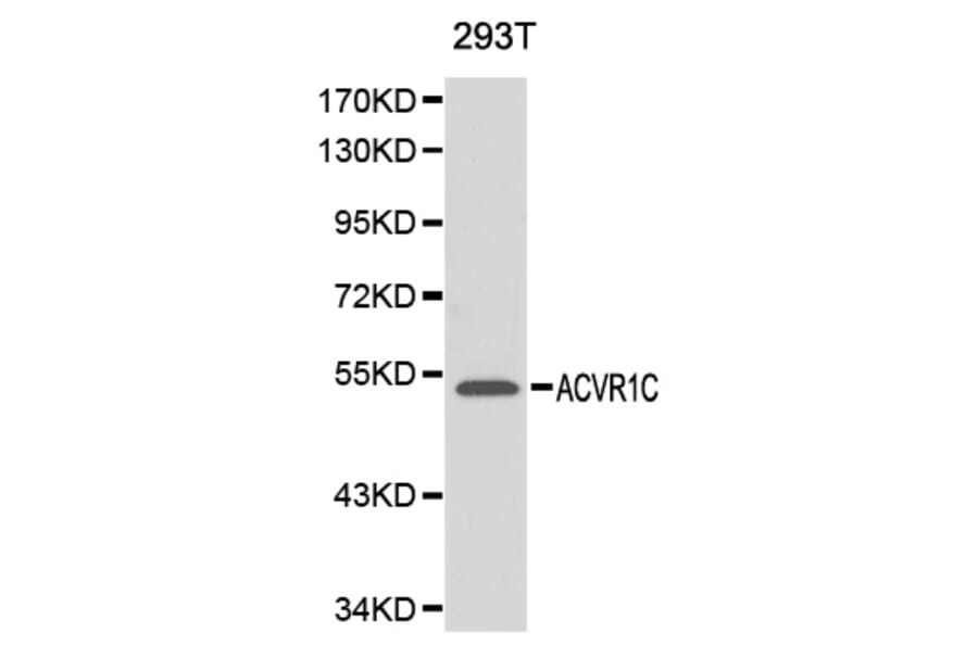 Western blot - ACVR1C antibody from Signalway Antibody (38141) - Antibodies.com