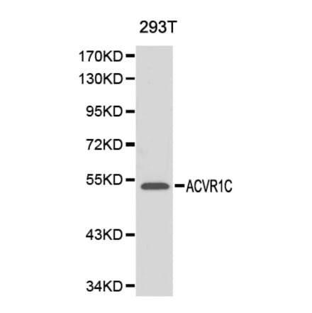Western blot - ACVR1C antibody from Signalway Antibody (38141) - Antibodies.com