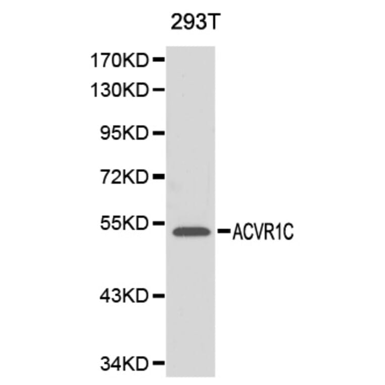 Western blot - ACVR1C antibody from Signalway Antibody (38141) - Antibodies.com