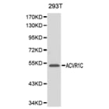 Western blot - ACVR1C antibody from Signalway Antibody (38141) - Antibodies.com