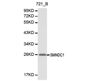 Western blot - SMNDC1 antibody from Signalway Antibody (38144) - Antibodies.com
