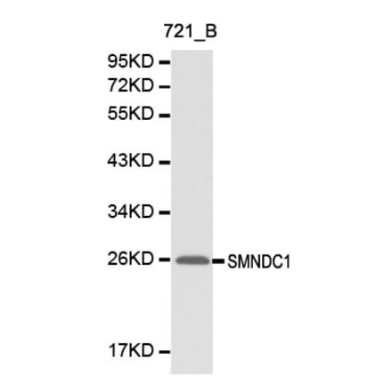 Western blot - SMNDC1 antibody from Signalway Antibody (38144) - Antibodies.com