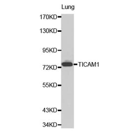Western blot - TICAM1 antibody from Signalway Antibody (38206) - Antibodies.com
