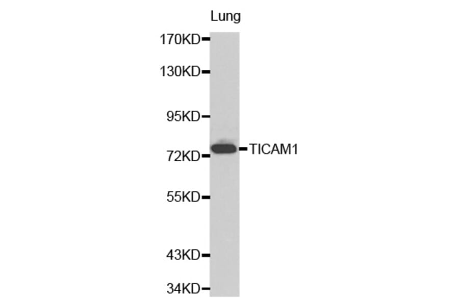 Western blot - TICAM1 antibody from Signalway Antibody (38206) - Antibodies.com
