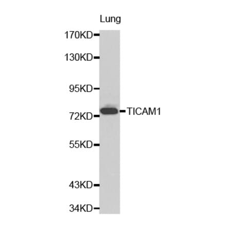 Western blot - TICAM1 antibody from Signalway Antibody (38206) - Antibodies.com