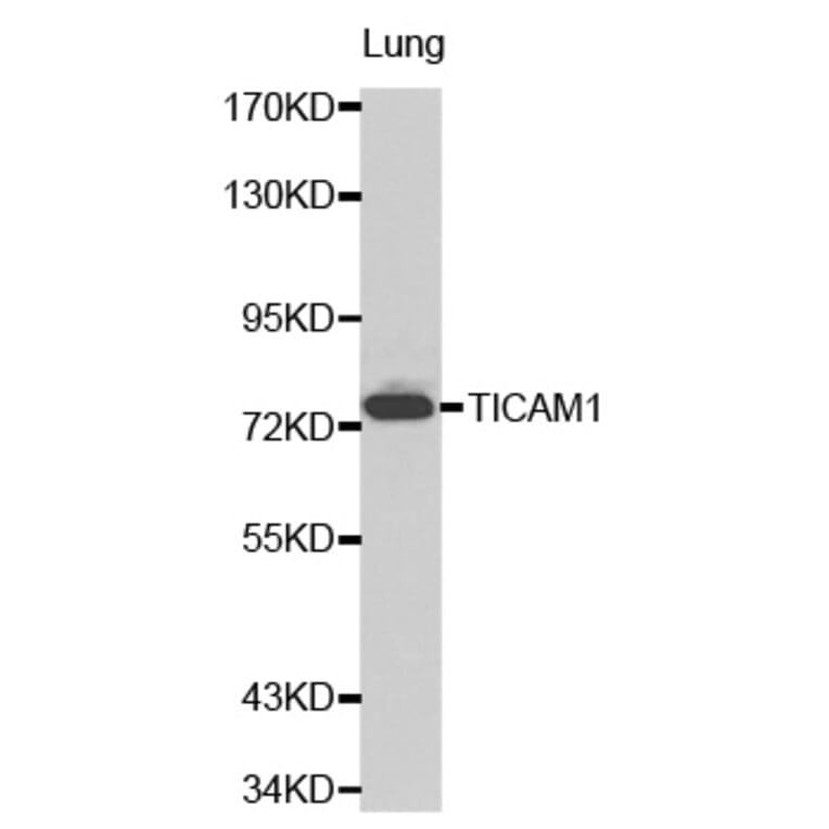 Western blot - TICAM1 antibody from Signalway Antibody (38206) - Antibodies.com