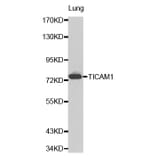 Western blot - TICAM1 antibody from Signalway Antibody (38206) - Antibodies.com