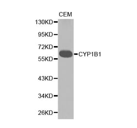 Western blot - CYP1B1 antibody from Signalway Antibody (38234) - Antibodies.com
