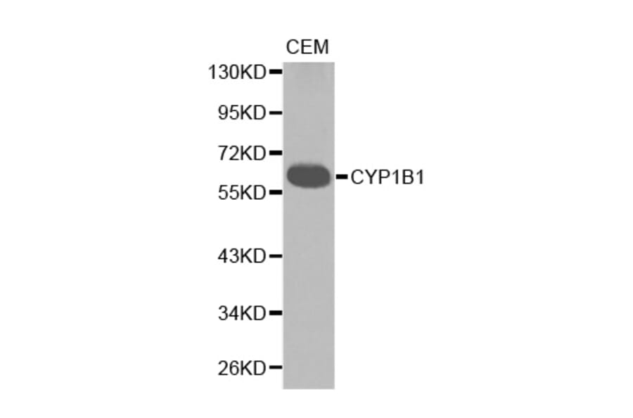 Western blot - CYP1B1 antibody from Signalway Antibody (38234) - Antibodies.com
