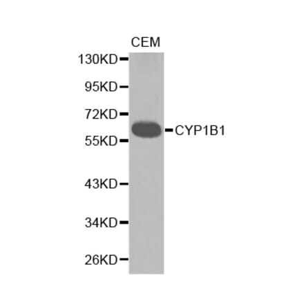 Western blot - CYP1B1 antibody from Signalway Antibody (38234) - Antibodies.com
