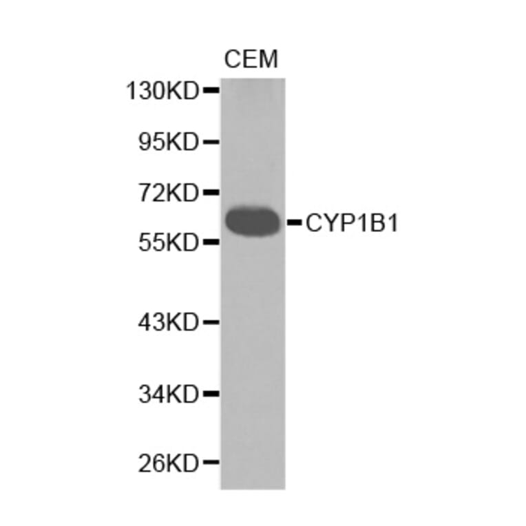 Western blot - CYP1B1 antibody from Signalway Antibody (38234) - Antibodies.com