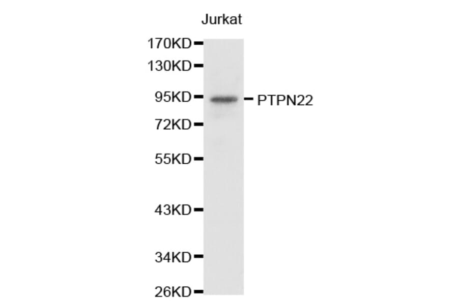 Western blot - PTPN22 antibody from Signalway Antibody (38238) - Antibodies.com