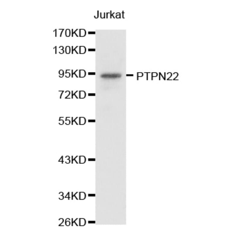 Western blot - PTPN22 antibody from Signalway Antibody (38238) - Antibodies.com