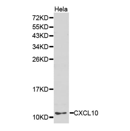 Western blot - CXCL10 antibody from Signalway Antibody (38240) - Antibodies.com