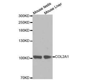 Western blot - COL2A1 antibody from Signalway Antibody (38254) - Antibodies.com