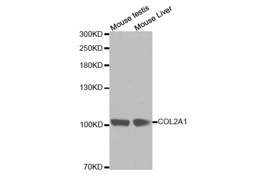 Western blot - COL2A1 antibody from Signalway Antibody (38254) - Antibodies.com