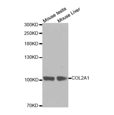 Western blot - COL2A1 antibody from Signalway Antibody (38254) - Antibodies.com