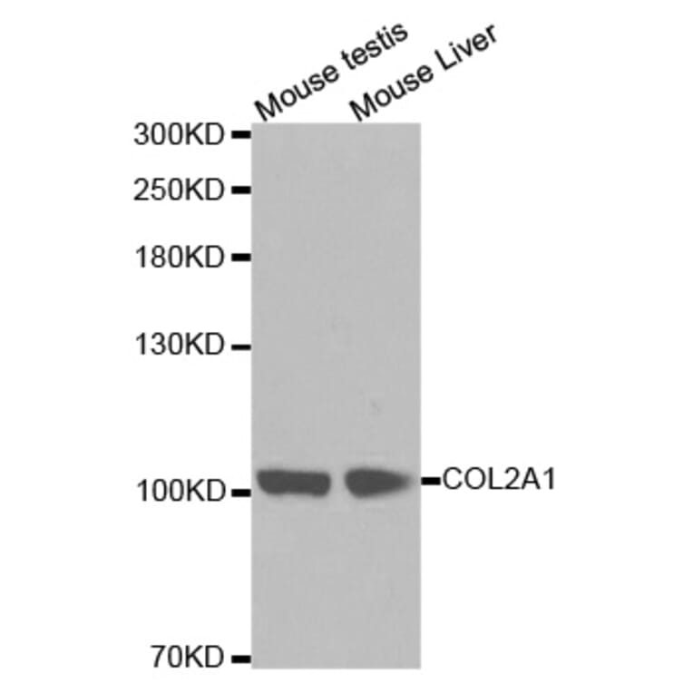 Western blot - COL2A1 antibody from Signalway Antibody (38254) - Antibodies.com