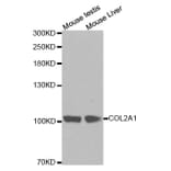 Western blot - COL2A1 antibody from Signalway Antibody (38254) - Antibodies.com
