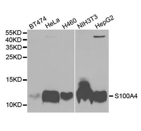 Western blot - S100A4 antibody from Signalway Antibody (38271) - Antibodies.com