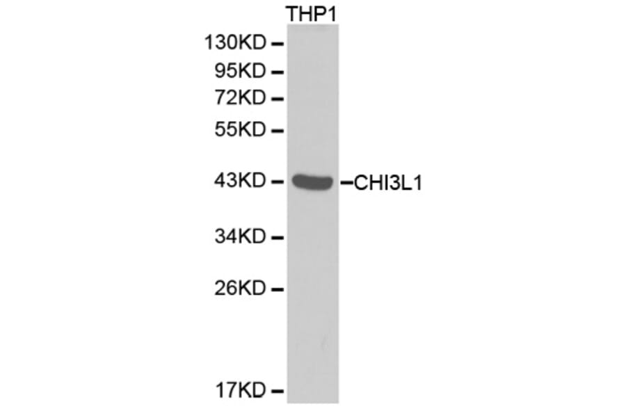Western blot - CHI3L1 antibody from Signalway Antibody (38288) - Antibodies.com