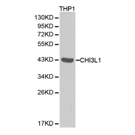 Western blot - CHI3L1 antibody from Signalway Antibody (38288) - Antibodies.com