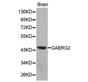 Western blot - GABRG2 antibody from Signalway Antibody (38291) - Antibodies.com