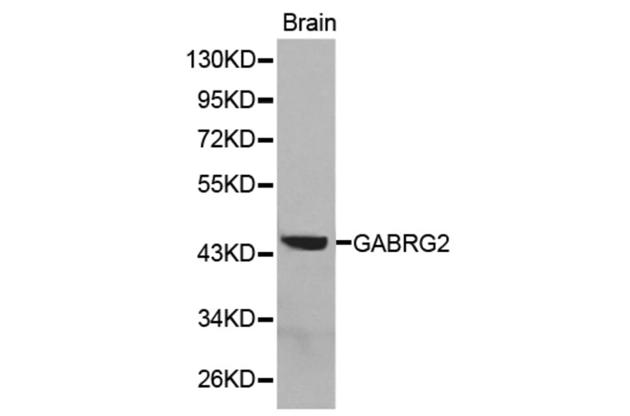 Western blot - GABRG2 antibody from Signalway Antibody (38291) - Antibodies.com