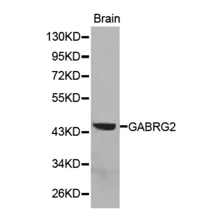 Western blot - GABRG2 antibody from Signalway Antibody (38291) - Antibodies.com